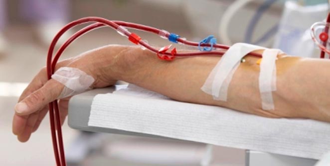 Dialysis