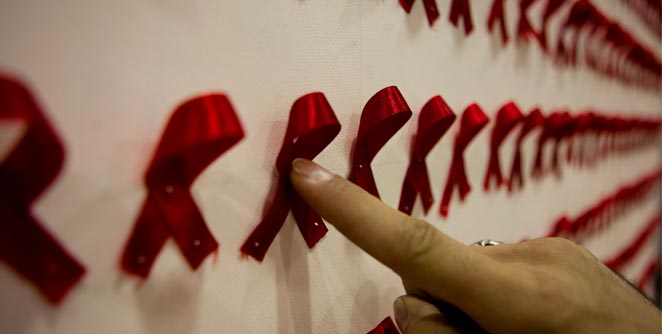 hiv