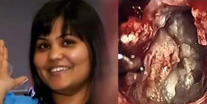 yamini