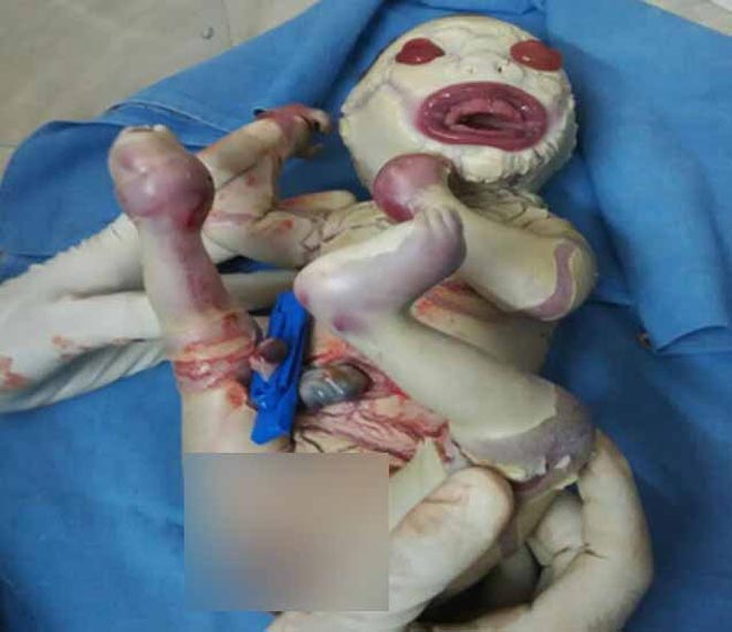 baby1