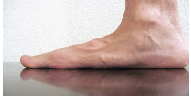 feet