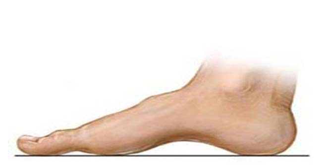 feet1