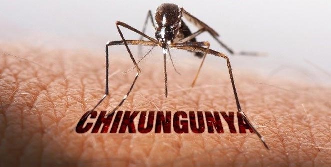 chikunguniya