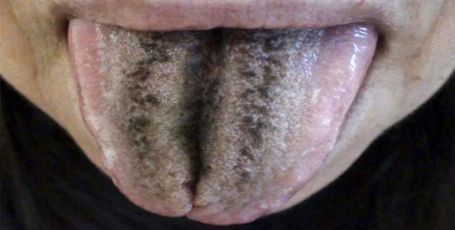 tounge2