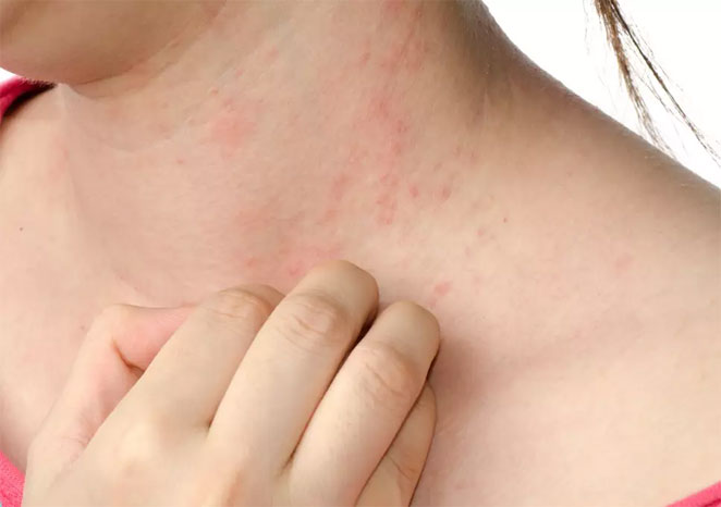 skin1