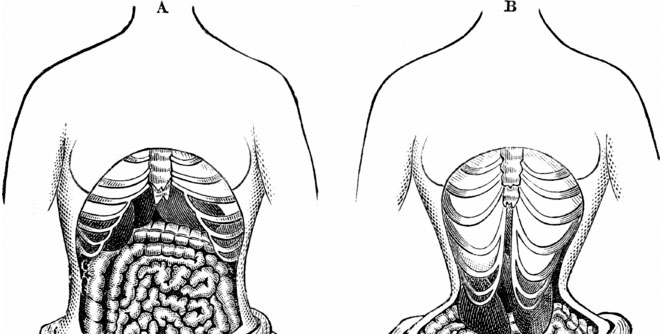 Tapeworm-Diet1