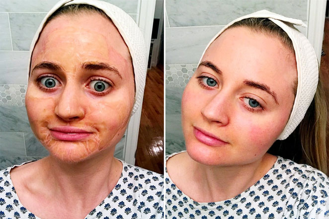 facial2