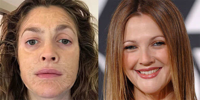 facial3
