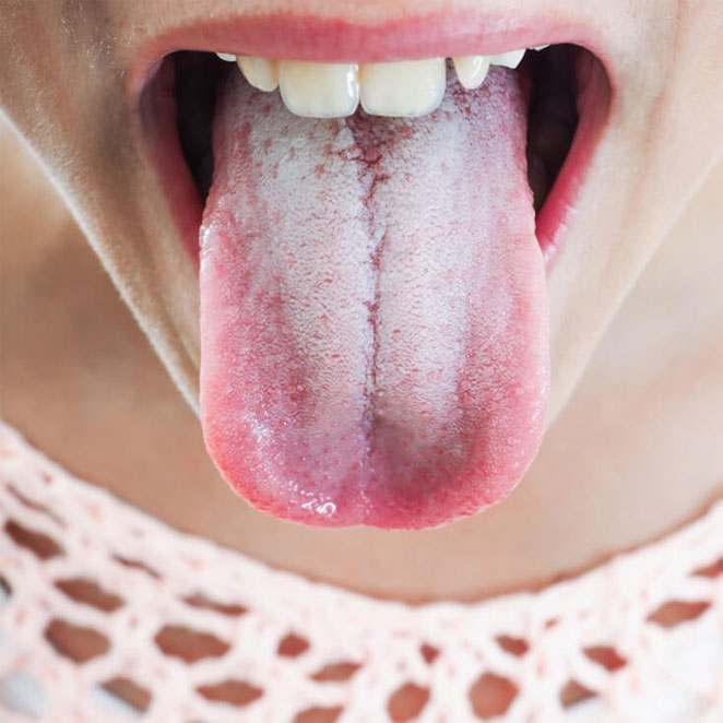 tongue2