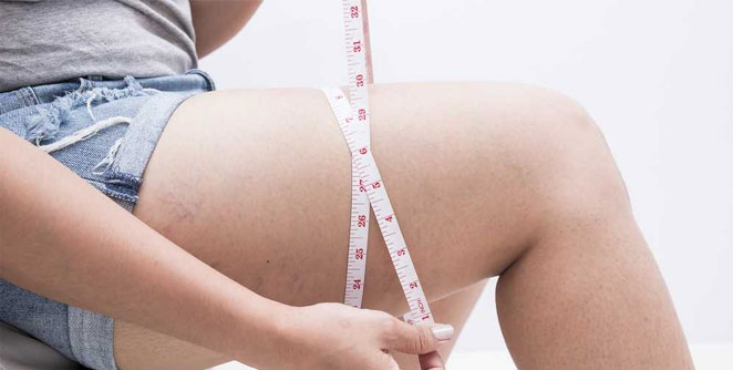 weight