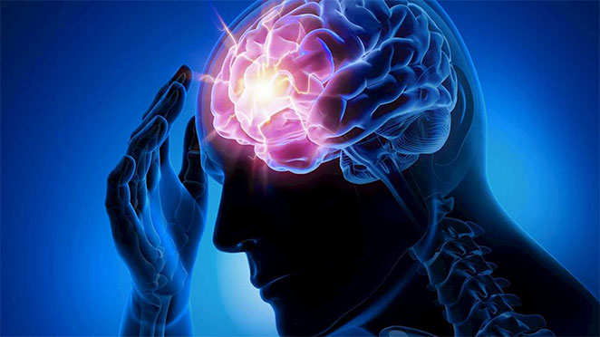 Epilepsy3