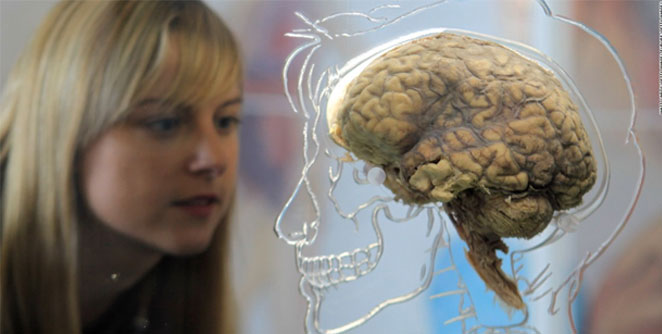 brain