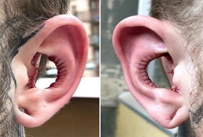 ear1