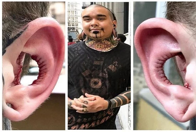ear2