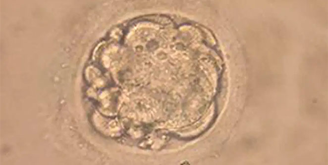 embryo