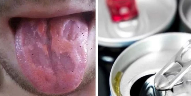 tongue